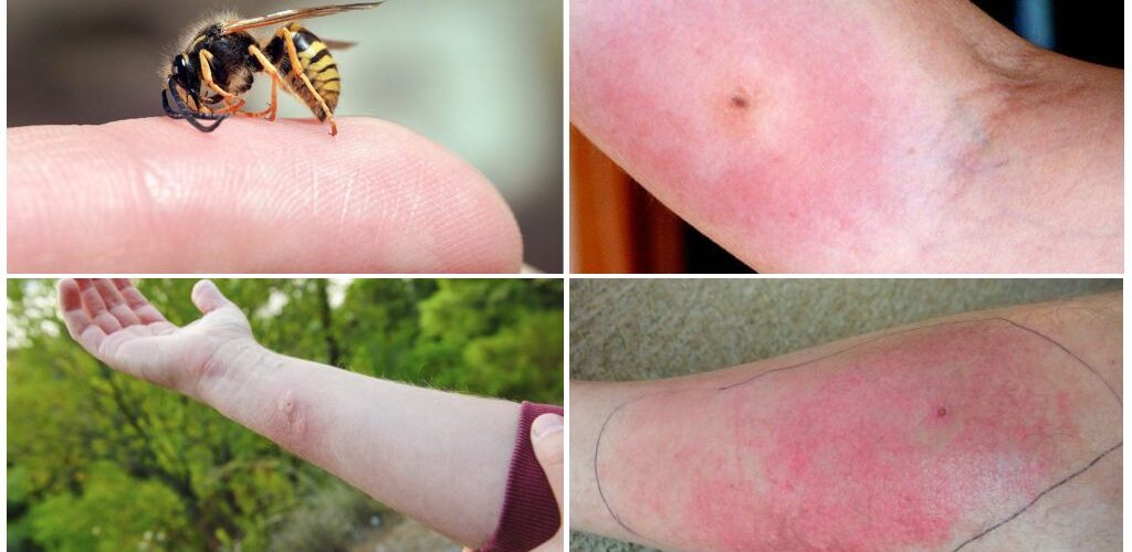 مكافحة الدبابير